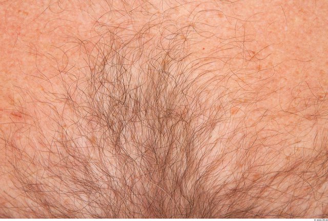 Hairy Skins