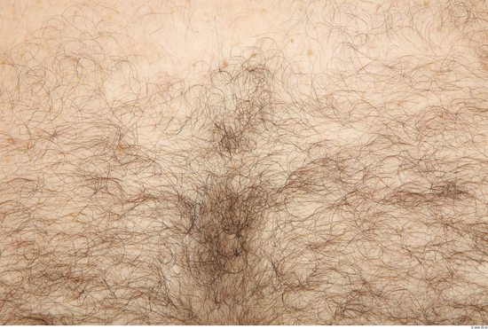 Hairy Skins