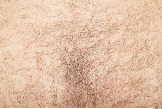 Hairy Skins