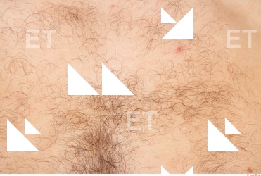 Hairy Skins
