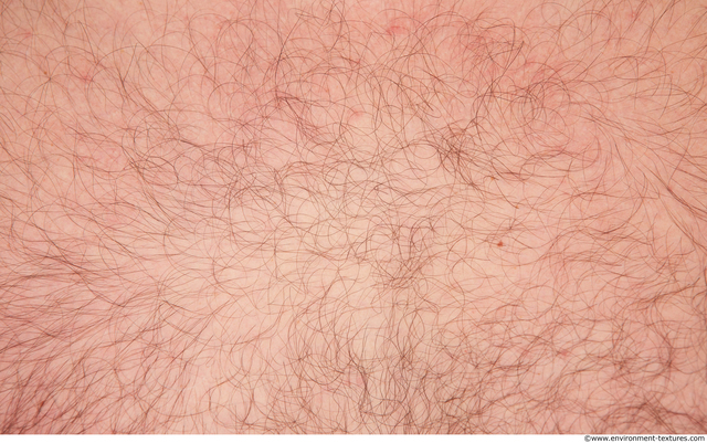 Hairy Skins