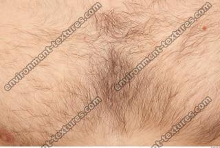 HumanSkinHairy0012